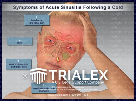Symptoms Of Acute Sinusitis Following A Cold My XXX Hot Girl