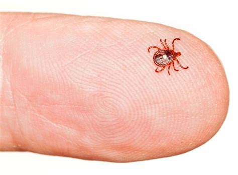 Red Meat Allergy From Tick Bites Increasing – Best Allergy Sites