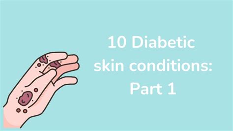 10 Diabetic Skin Conditions Part 1 Blulyte