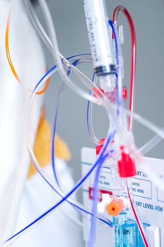 Intravenous Drip And Haemodynamic Monitoring System In The Icu Stock