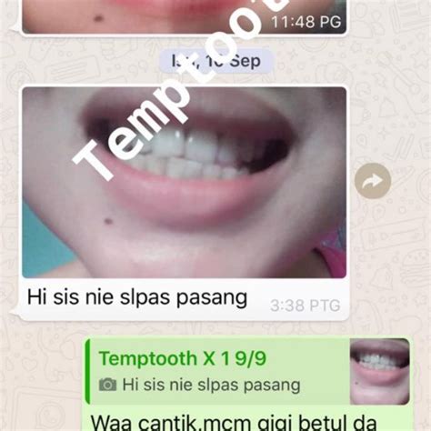 Check spelling or type a new query. Harga Gigi Palsu Di Rumah Sakit - Sekitar Rumah