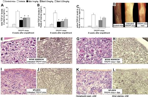 Bortezomib Impairs Marrow And Spleen Fibrosis Development In Tpo High