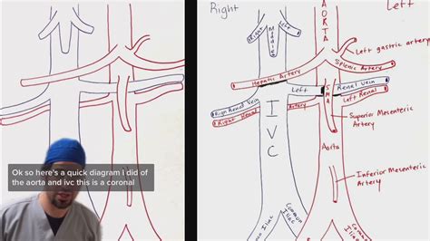 Aorta And Ivc Breakdown For Ultrasound Youtube