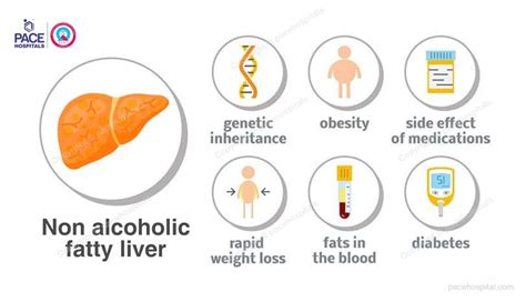 Non Alcoholic Fatty Liver Disease Causes Symptoms Diagnosis And