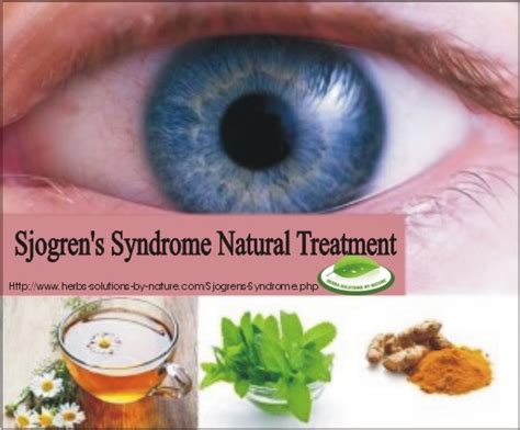 8 Natural Treatment Sjogrens Syndrome Dry Eyes Herbs Solutions By Nature