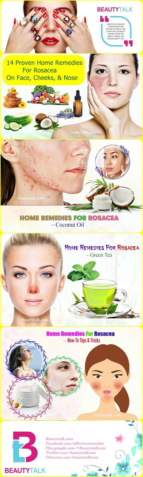 14 Proven Home Remedies For Rosacea On Face Cheeks And Nose That Work