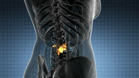 12 photos of the human back bones. Backache in Back Bones | Human spine, Backache, Animal illustration