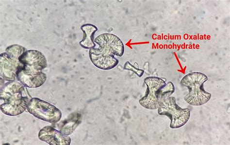 Imagen Microscópica Que Muestra Cristales De Monohidrato De Oxalato De