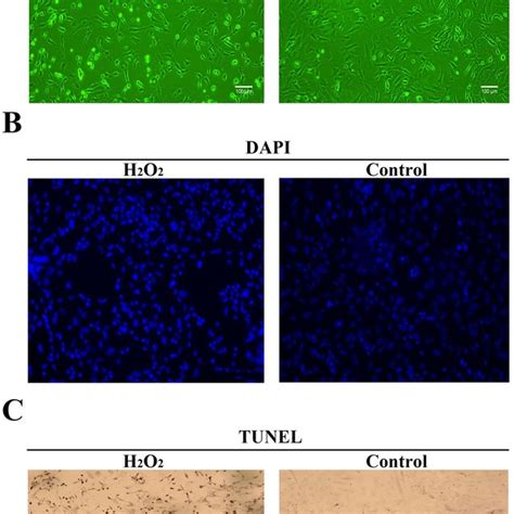 H 2 O 2 Induces Apoptosis In Def Cells A Cells Were Observed Using