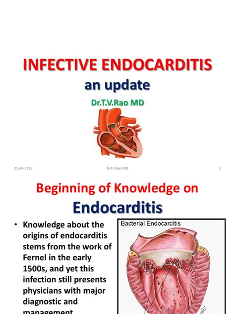 Infective Endocarditis Streptococcus Diseases And Disorders