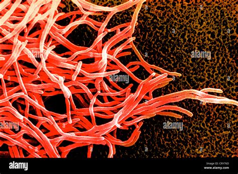 Nocardia Bacteria Hi Res Stock Photography And Images Alamy
