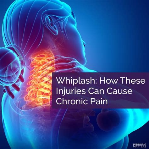 Whiplash How These Injuries Can Cause Chronic Pain Mount Pleasant