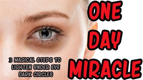 3 Magical Steps To Lighten Dark Circles Under Eyes In 1 Day Youtube