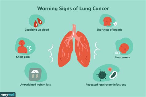 Lung Cancer Cough Symptoms And Characteristics