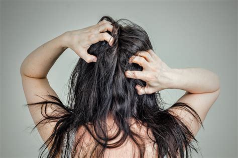 Cara menghilangkan telur kutu di rambut secara alami bisa dengan sisir serit, minyak kelapa, minyak zaitun, dan minyak esensial lainnya. 7 Cara Menghilangkan Kutu Rambut dengan Cepat - Berkeluarga