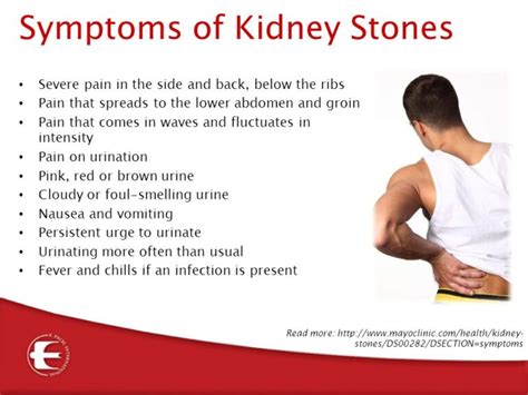Do Kidney Stones Cause Abdominal Swelling The Best Types Of Stone