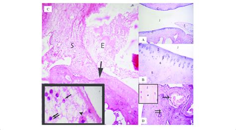 …unlike other long bones of the skeleton, vertebral body epiphyses never ossify, and after the end of the growth period of life they are reduced into thin the entire thing is called intervertebral symphysis. | (A) Ankle joint of the control group showing the ...