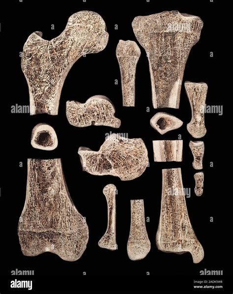 Inner Structure Of Bones Historical Anatomical Artwork Bone Can Be