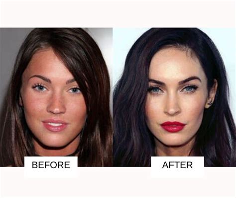 Celebrity Plastic Surgery 31 Before And After Images