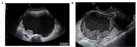 Sensitivity and specificity of multimodal and ultrasound. The characteristic ultrasound features of specific types ...