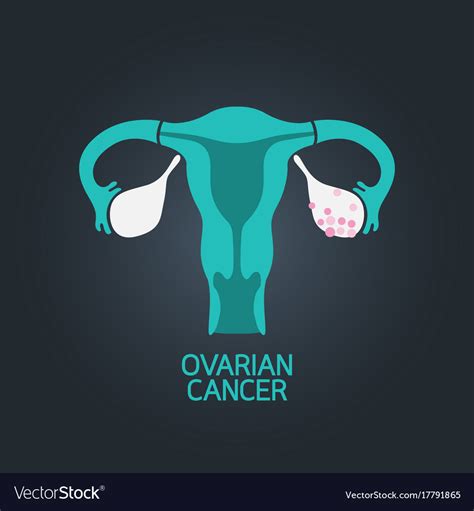 Ovarian Cancer Logo Icon Royalty Free Vector Image