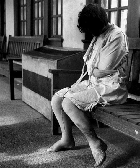 Jerry Cooke A Female Patient Who Is Restrained In A Straightjacket Sits Alone On A Bench And