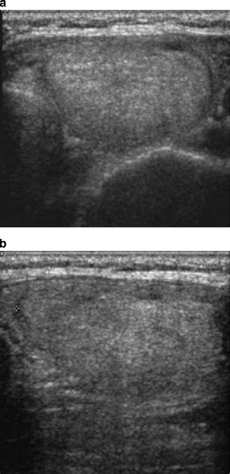 Figure 1 From The Diagnostic Accuracy Of Ultrasound Guided Fine Needle