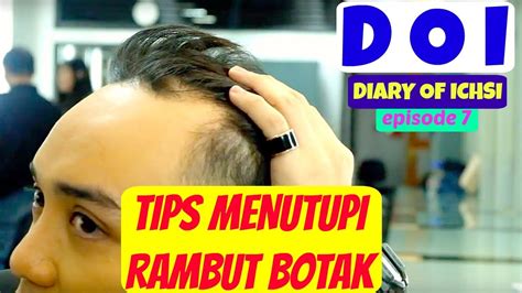 Gaya rambut pendek pria botak depan. Potongan Rambut Pria Berambut Tipis - Model Rambut