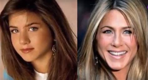 One of the things we love most about them is how refreshingly honest they've been about their experiences with plastic surgery. Jennifer Aniston Plastic Surgery - Before and After ...