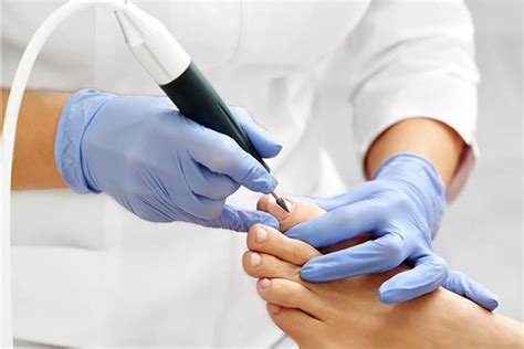 Krwiak Pod Paznokciem Przyczyny Objawy Leczenie Portal Kosmetologa