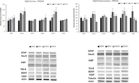 Tulio (kevin kline) e miguel (kenneth branagh) são dois vigaristas que vivem de pequenos golpes. Frontiers | Brain Metabolism Alterations Induced by Pregnancy Swimming Decreases Neurological ...