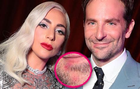 Der Chirurg Warum Nicht Eilen Bradley Cooper Kiss Lady Gaga Stelle Gemüsehändler Rückschnitt