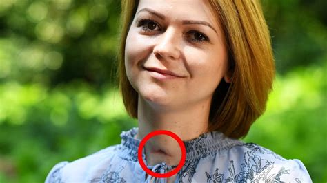 ex spy s poisoned daughter yulia skripal recovering with neck scar pictures au