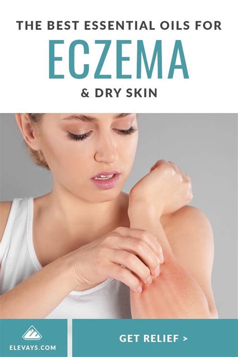 The Best Essential Oil For Eczema And Dry Skin Essential Oils For