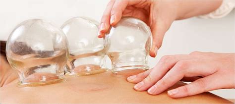 Cupping Therapy Near Me In Montvale And Closter Nj