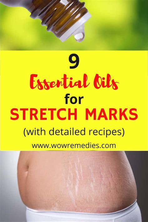 Best Essential Oils For Stretch Marks Oil For Stretch Marks Stretch