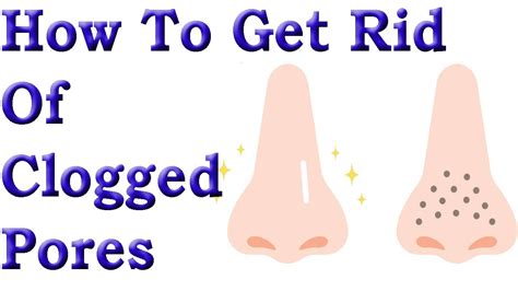 How To Get Rid Of Clogged Pores Remove Clogged Pores Naturally Youtube