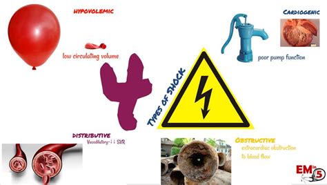 Contamination is the presence of a constituent, impurity, or some other undesirable element that spoils, corrupts, infects, makes unfit, or makes inferior a material, physical body, natural environment. Shock! The 4 Types of Shock - EM in 5