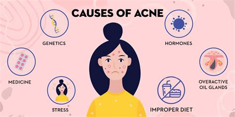 The Best Skincare Routine For Acne Prone Skin Sugar Cosmetics Blog