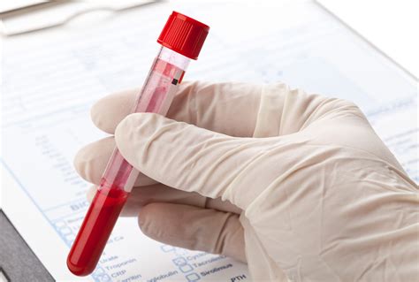 Std Blood Test Results Explained Same Day Std Testing In Clia Certified Labs