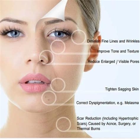 Derma Roller Skin Treatment Aesthetic Clinic Malaysia Klinik Dr Inder