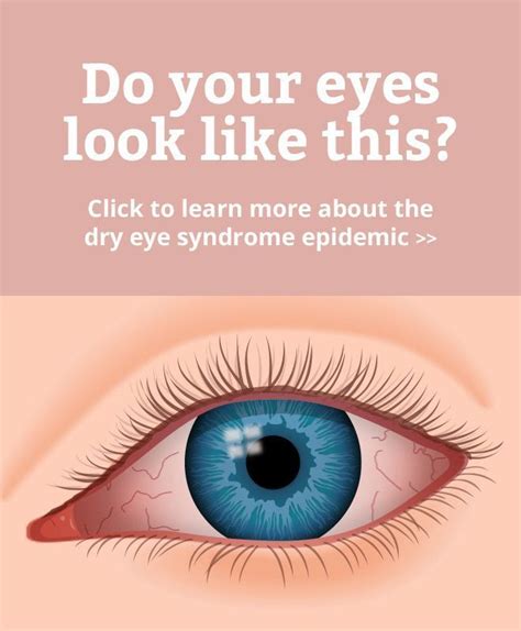 10 Symptoms Of Dry Eye Syndrome Possible Causes Chronic Dry Eye