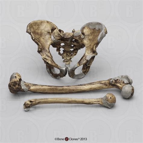 Neanderthal Pelvis Femur And Humerus Set Bone Clones Inc Osteological Reproductions