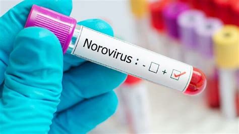 Aktuelle news und infos zum norovirus 2021 finden sie hier. Norovirus: la nueva pandemia del 2021 llega desde China