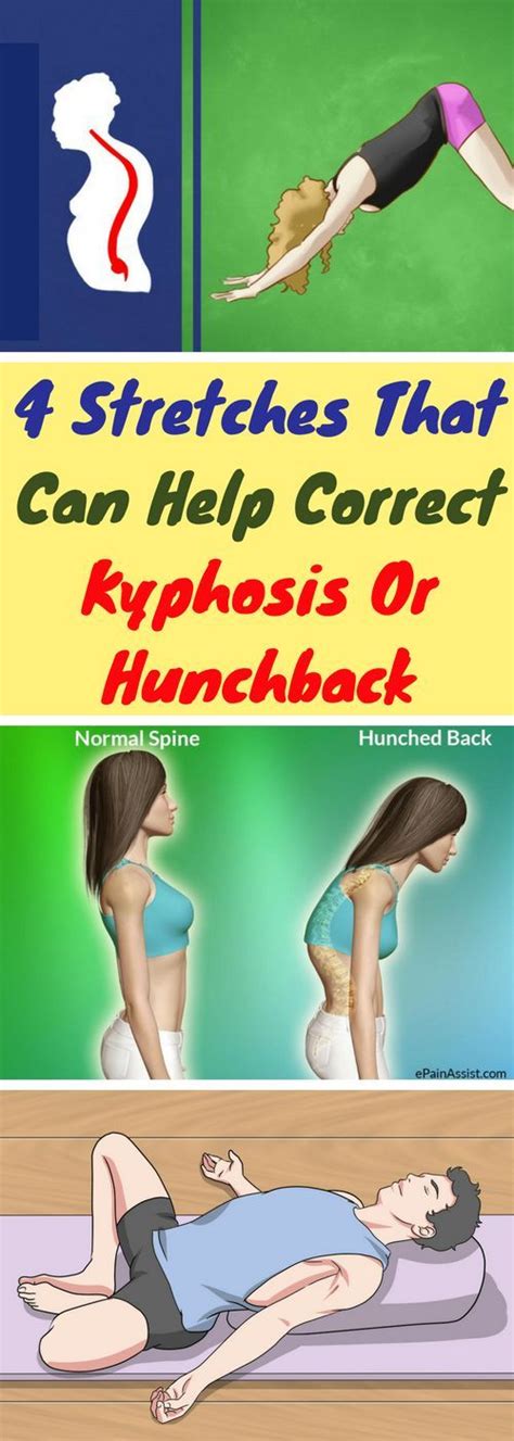 4 Stretches That Can Help Correct Kyphosis Or Hunchback Exercise