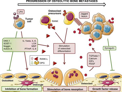 Bone Metastasis Mechanisms Therapies And Biomarkers Physiological