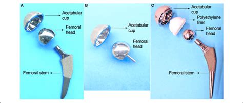 Three Main Types Of Hip Implants A Large Head Metal On Metal Mom