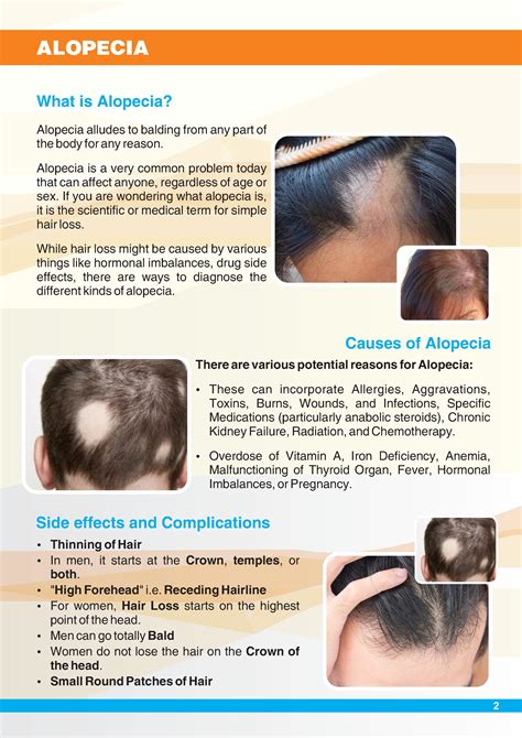 What Is Alopecia Hair Loss Typescausesdiagnosis And