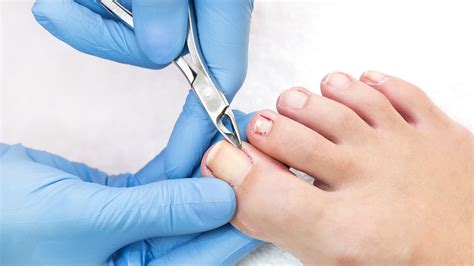 What Is A Podiatrist Morecrofts Podiatry Services Lilydale