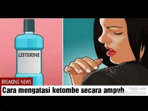 Cara mengatasi ketombe secara ampuh - YouTube